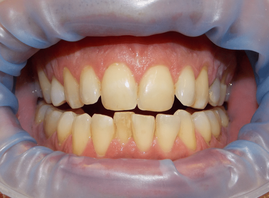 Lijepi i lijepo posloženi zubi 